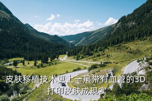 3d打印與醫(yī)學結(jié)合上市公司,3D打印設(shè)備上市公司龍頭